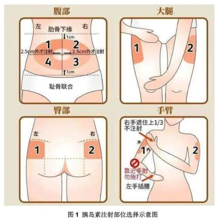 图片4.png